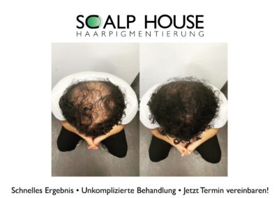 Scalphouse Haarpigmentierung
