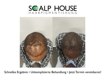 Scalphouse Haarpigmentierung